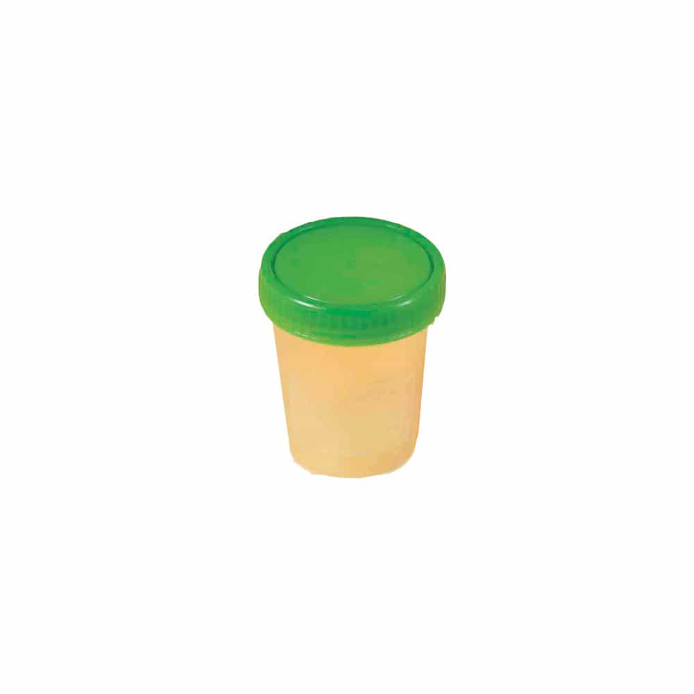 URINBECHER mit Schraubdeckel 100 St