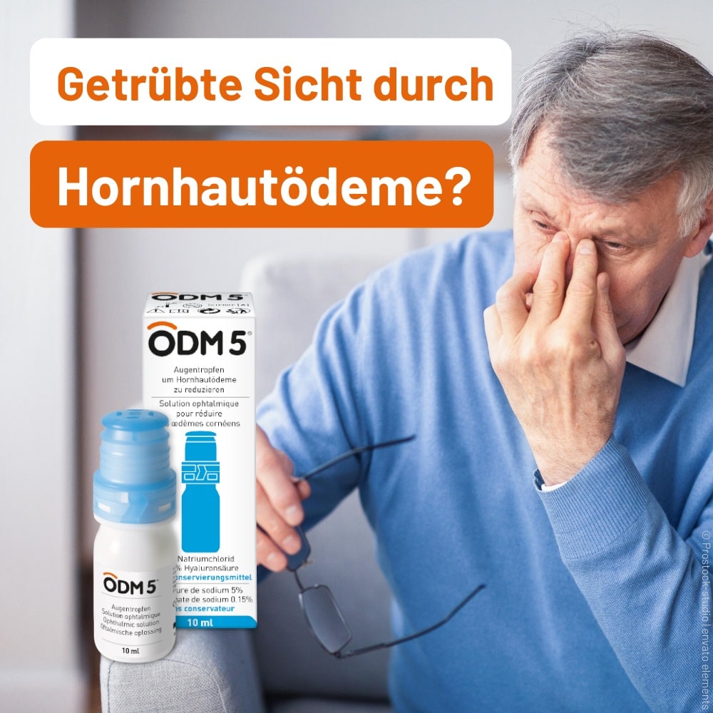 ODM 5 Augentropfen 1X10 ml Augentropfen