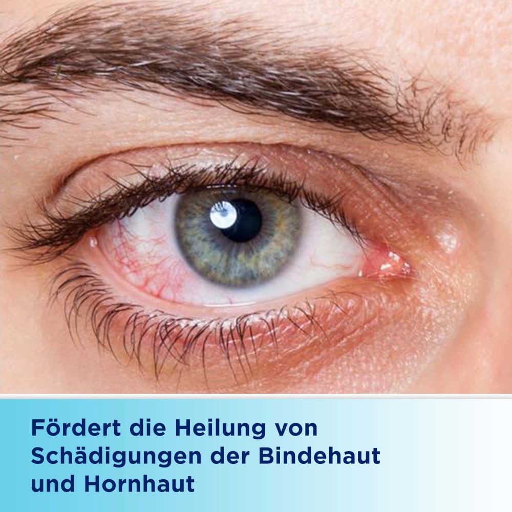 Bepanthen AUGEN- UND NASENSALBE 10 g Augen- und Nasensalbe