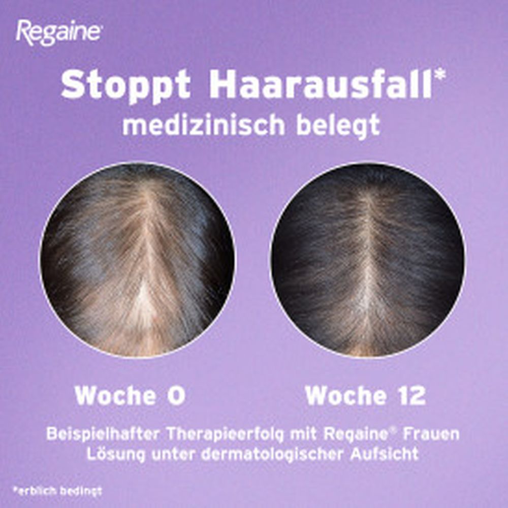 Regaine FRAUEN SCHAUM (4 Monats Packung) bei erblich bedingtem Haarausfall