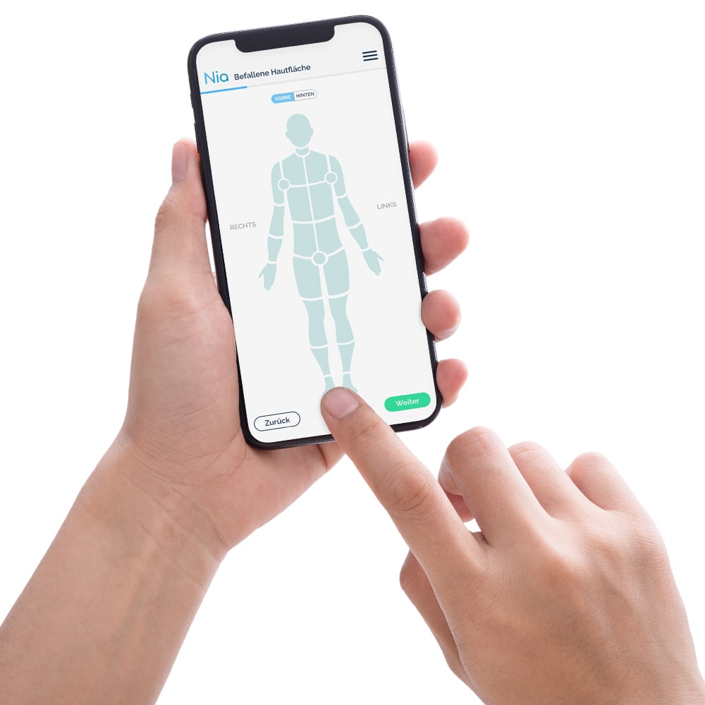 Neurodermitis App Nia 1 St