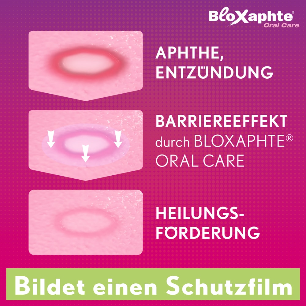 Bloxaphte Oral Care Mundspray bei Aphthen und Verletzungen im Mund 20 ml Spray