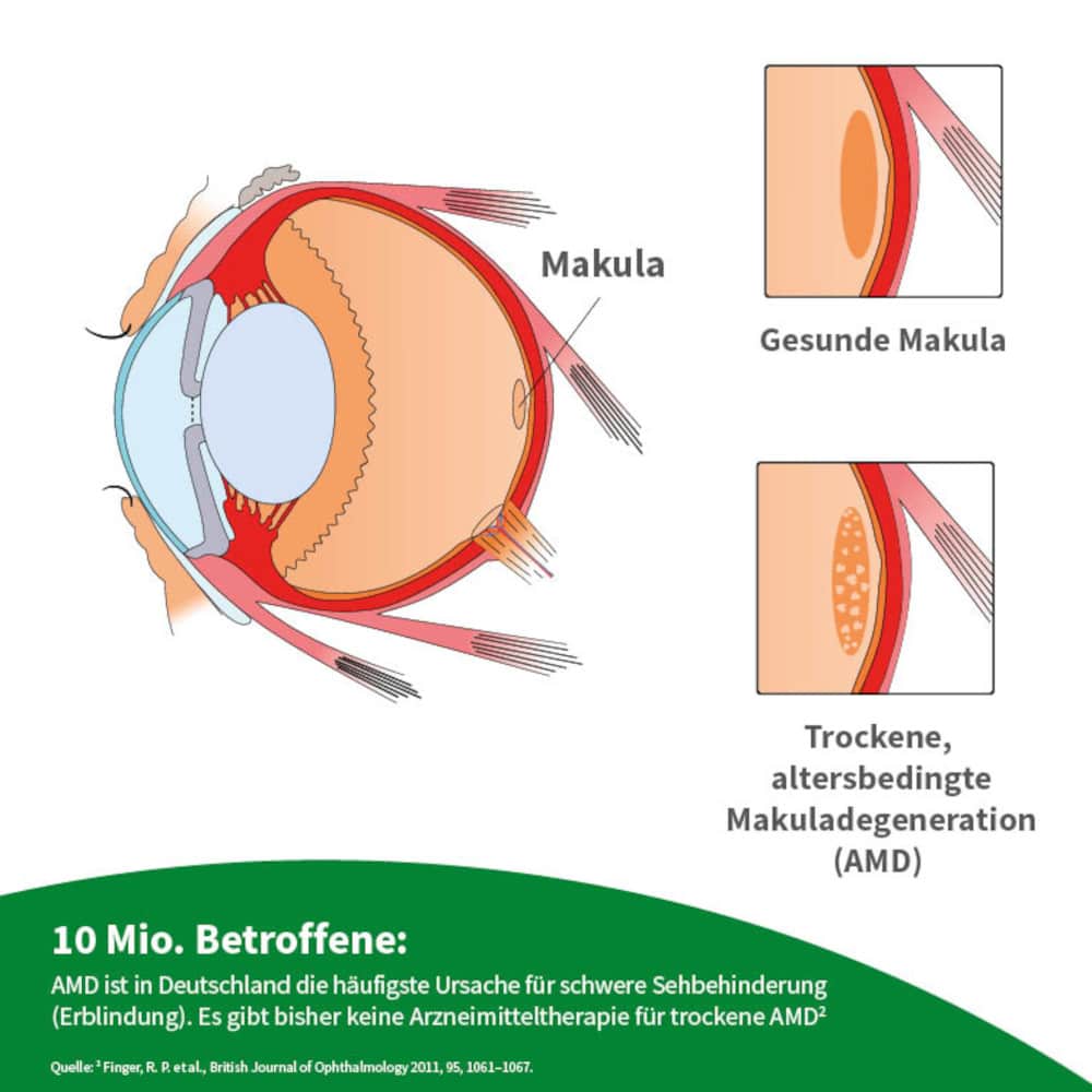 beh Makula 84 St Kapseln