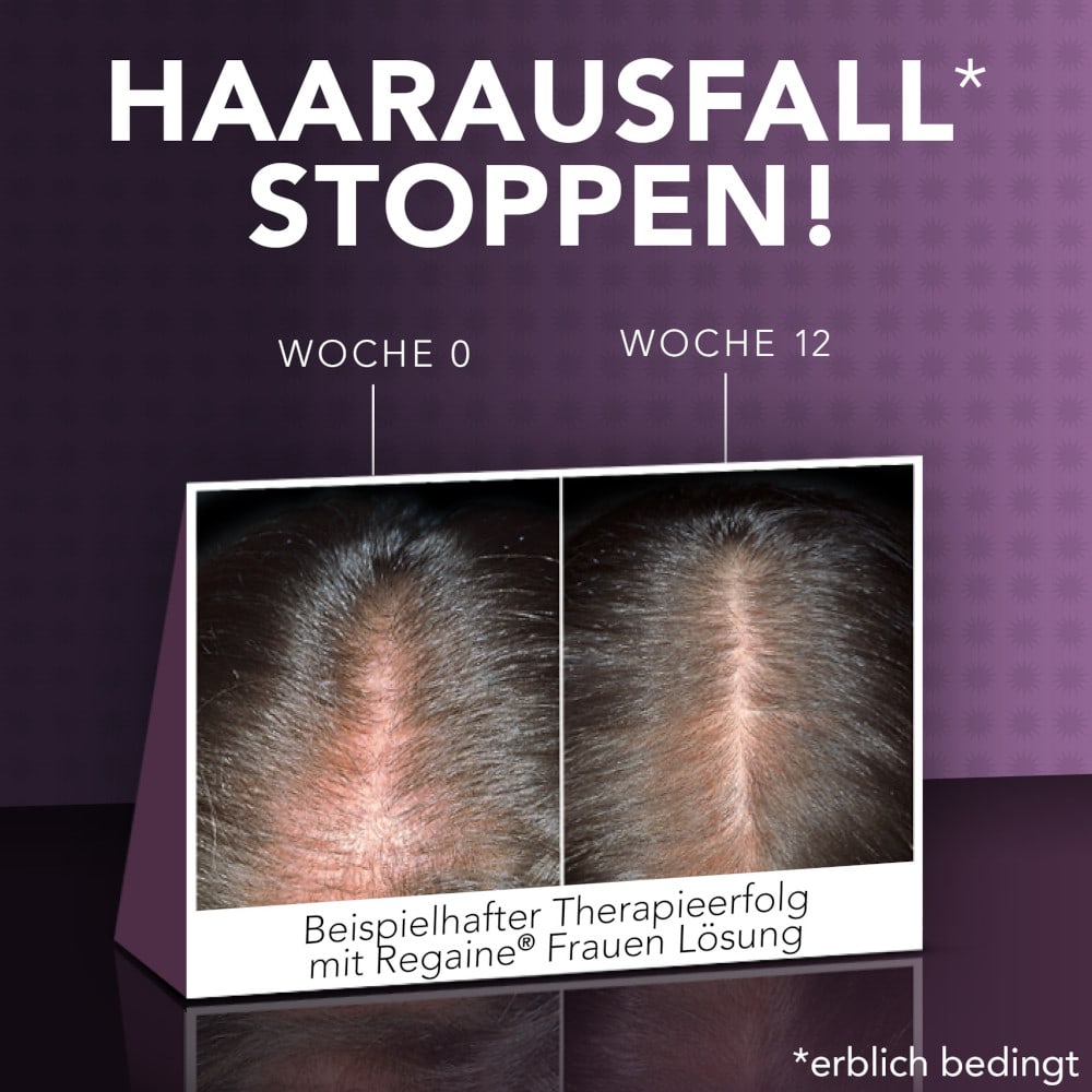 Regaine Frauen Schaum Doppelpack 2X2X60 g Schaum