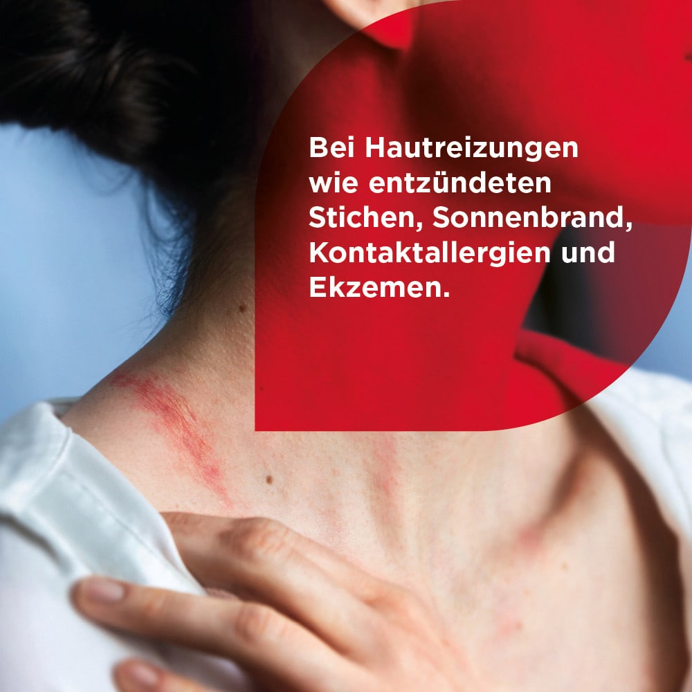 Soventol HydroCortisonACETAT 0,5% bei Hautentzündungen 15 g Creme