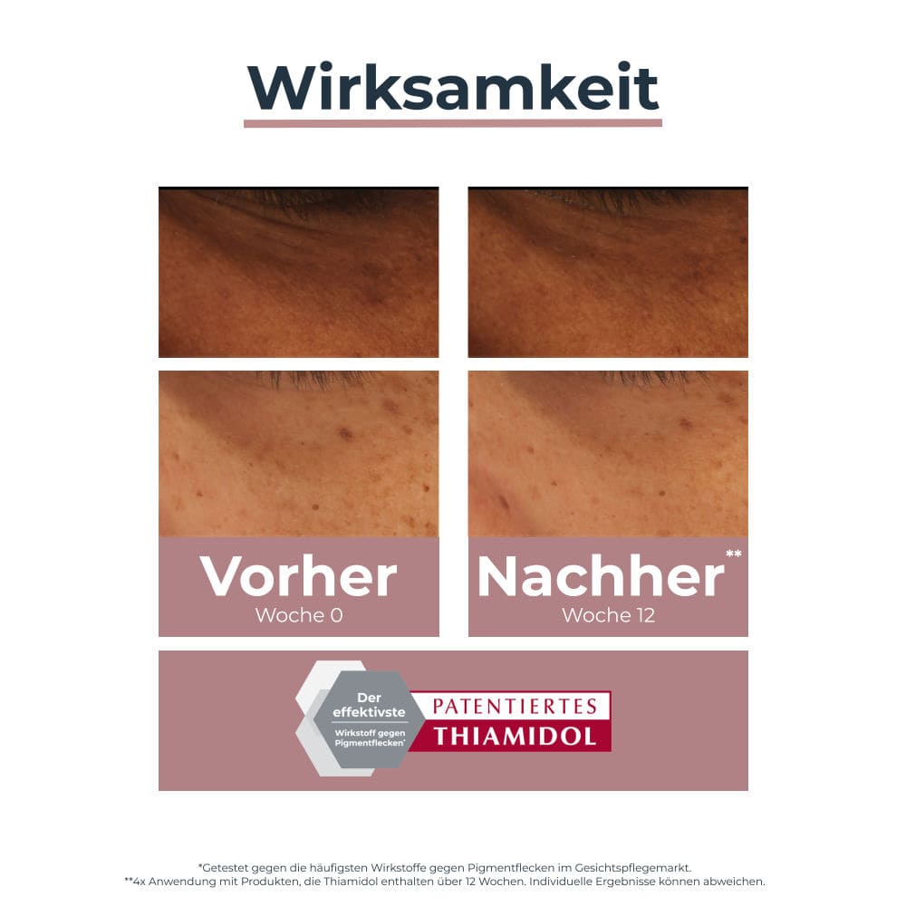 Eucerin ANTI PIGMENT AUGENRINGE KORRIGIERENDE AUGENPFLEGE  15 ml Augencreme
