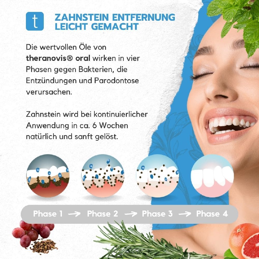 theranovis oral Zahnstein gel  120 ml Gel