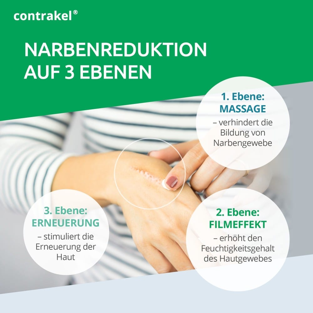 Contrakel Narbencreme mit Kelosun Sonnenschutz 30 ml Creme