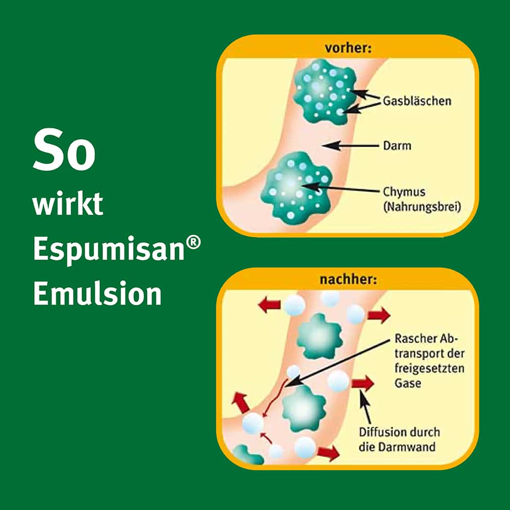 Espumisan EMULSION 30 ml Emulsion