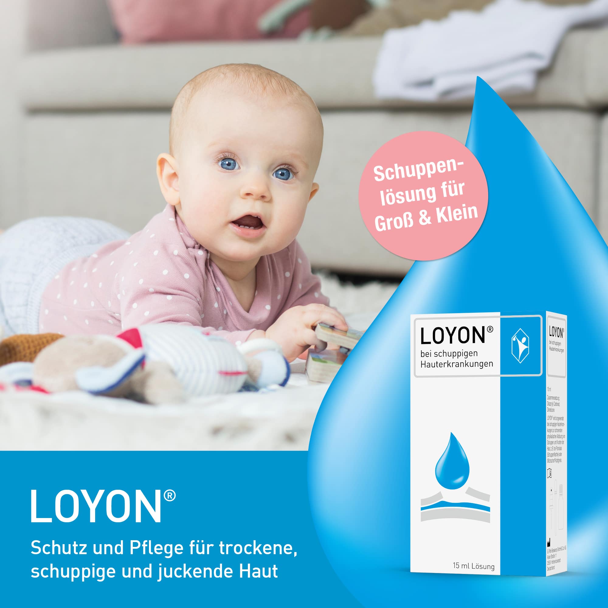 LOYON bei Schuppenflechte, Milchschorf & Kopfgneis 15 ml Lösung 15 ml Lösung