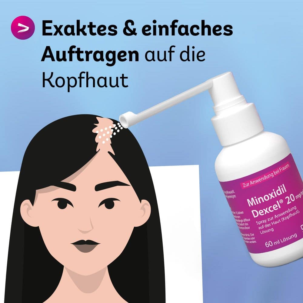 Minoxidil Dexcel 20 mg/ml 3X60 ml Lösung
