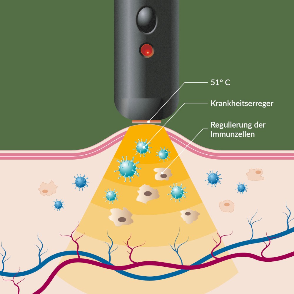 HERPOTHERM Original 1 St
