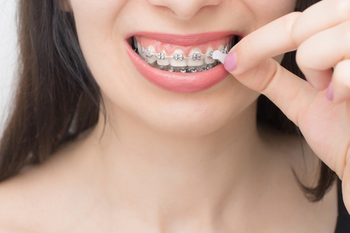 GUM Ortho Wachs 1 St