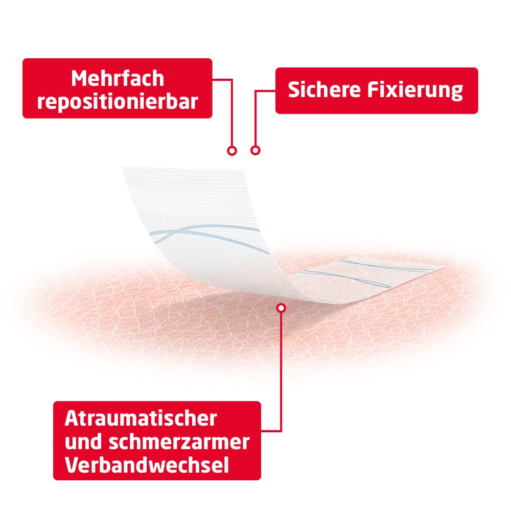 Fixomull skin sensitive 10 cm x 5 m 1 St Pflaster
