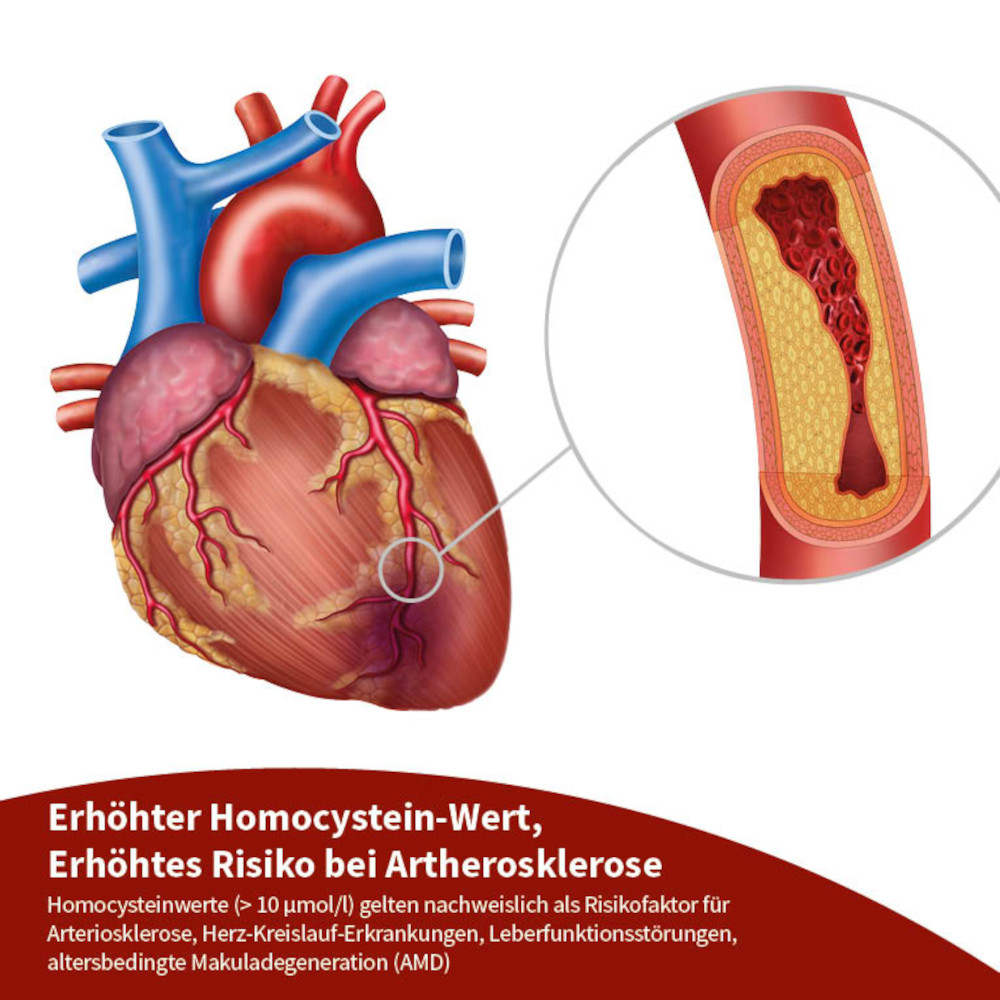 beh Arterie+ 30 St Kapseln