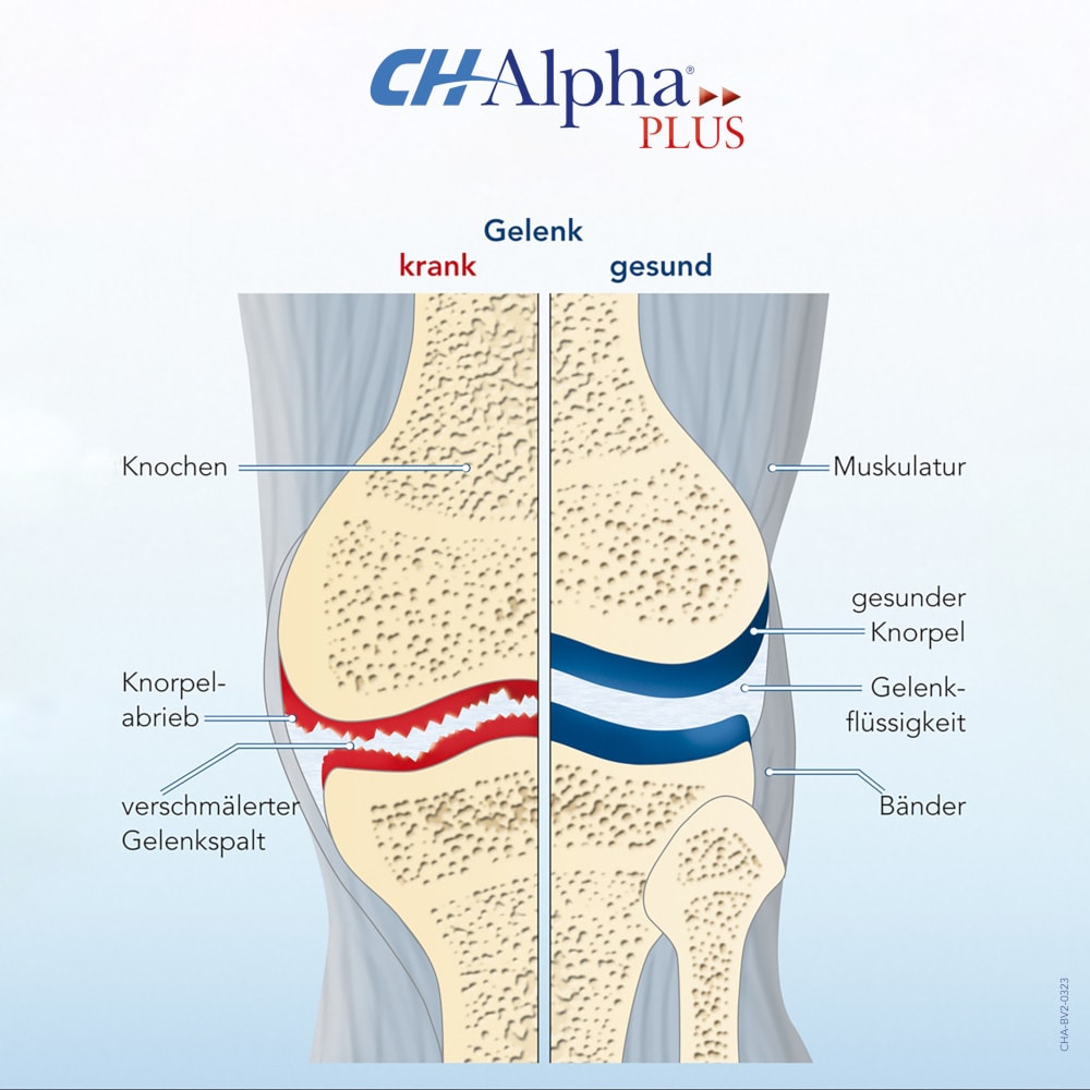 CH Alpha Gelenk-Gel 100 ml Gel