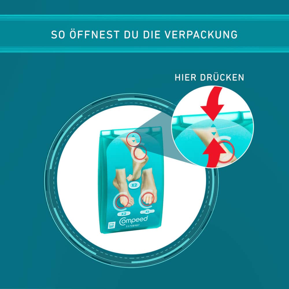 COMPEED Blasenpflaster Mixpack 5 St Pflaster