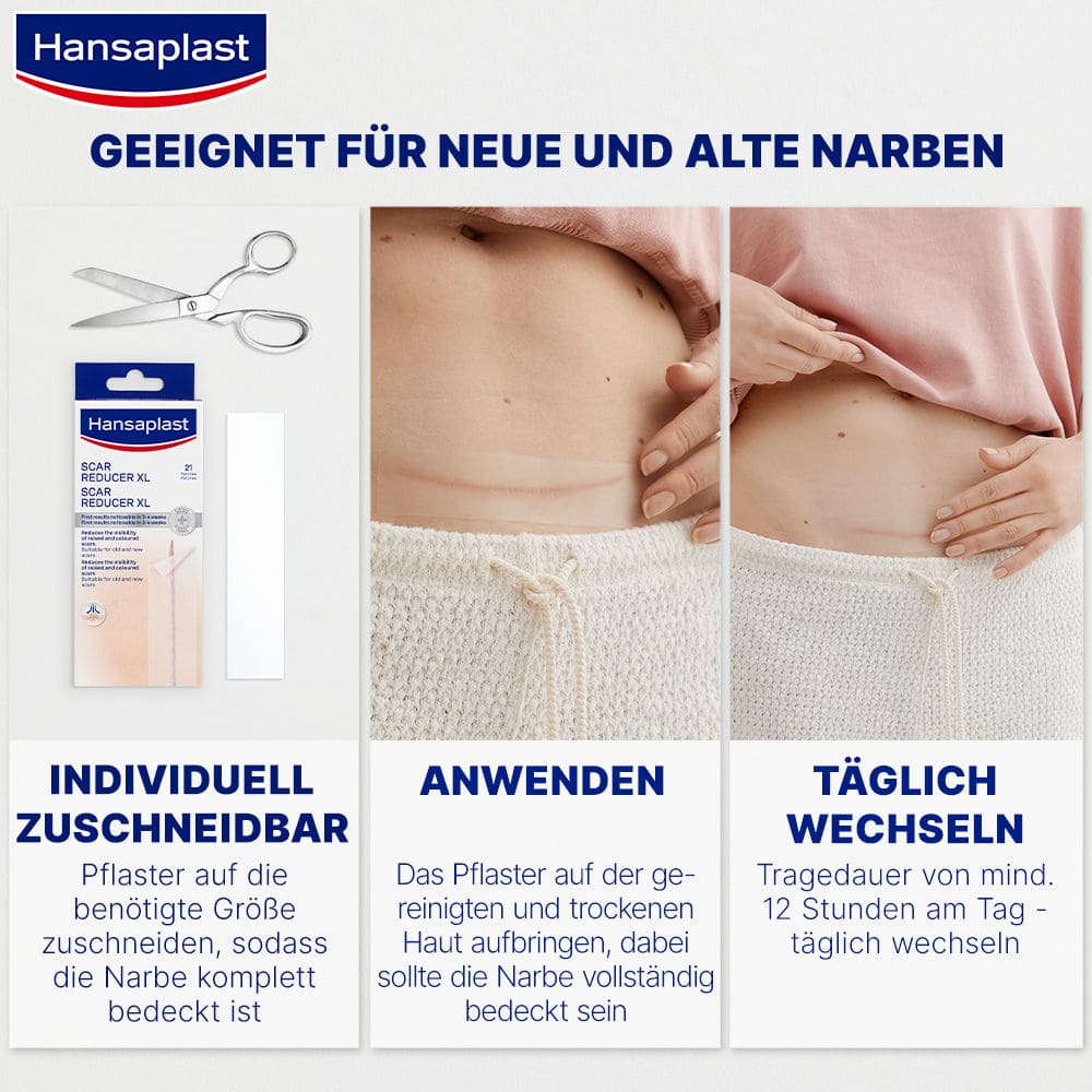 Hansaplast Narben Reduktion, 21 Pflaster 21 St Pflaster