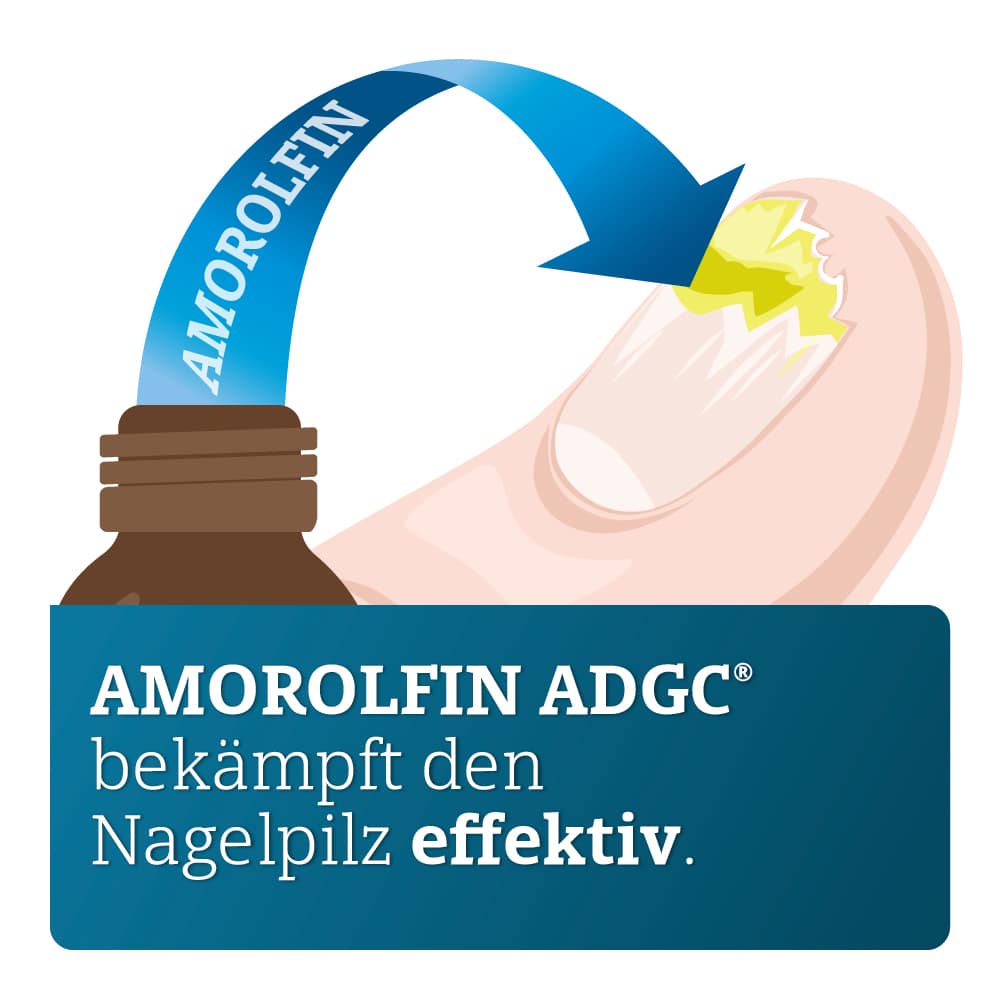 AMOROLFIN ADGC 50 mg/ml  5 ml Wirkstoffhaltiger Nagellack
