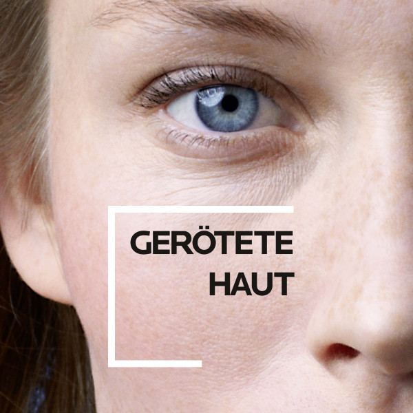 LA ROCHE-POSAY Rosaliac UV Feuchtigkeitspflege gegen Rötungen 40 ml Creme LA ROCHE-POSAY Rosaliac UV Feuchtigkeitspflege gegen Rötungen 40 ml Creme