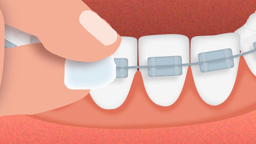 GUM ORTHO Wachs Mint 1 St