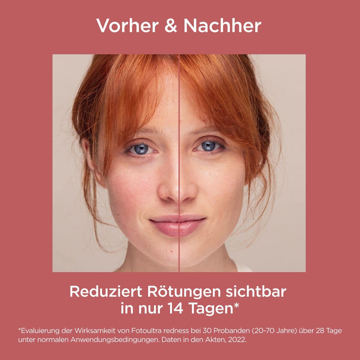 ISDIN FOTOULTRA Redness LSF 50 50 ml Creme