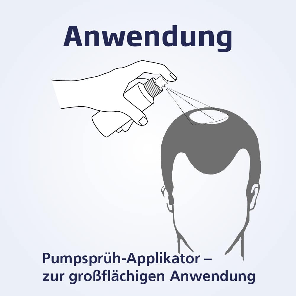 MINOXICUTAN Männer 50 mg/ml Spray 3X60 ml Lösung