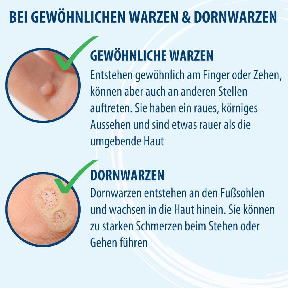 Evolsin Anti Warzen Stift 3 ml Stifte