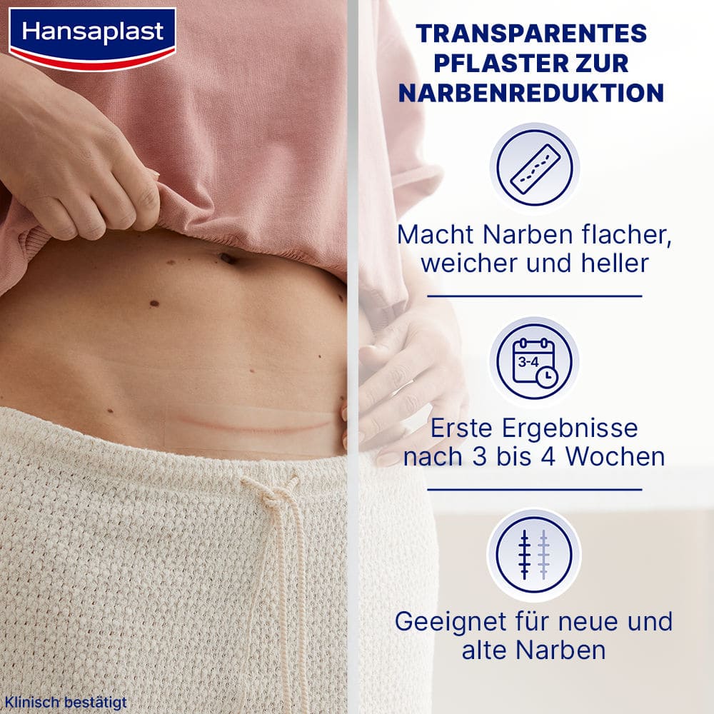 Hansaplast Narben Reduktion XL, 21 Pflaster 21 St Pflaster
