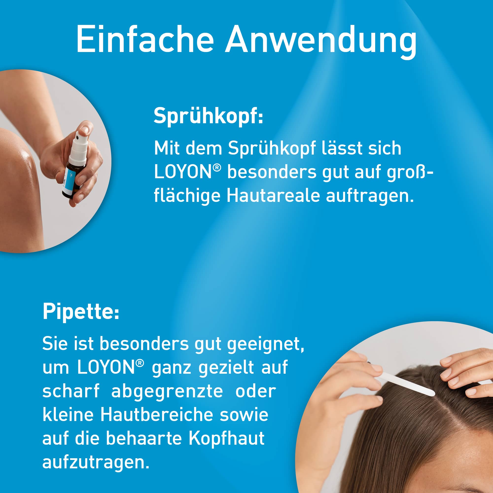 LOYON bei Schuppenflechte, Milchschorf & Kopfgneis 15 ml Lösung 15 ml Lösung