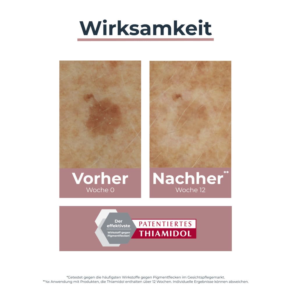Eucerin ANTI PIGMENT KORREKTURSTIFT  5 ml Stifte