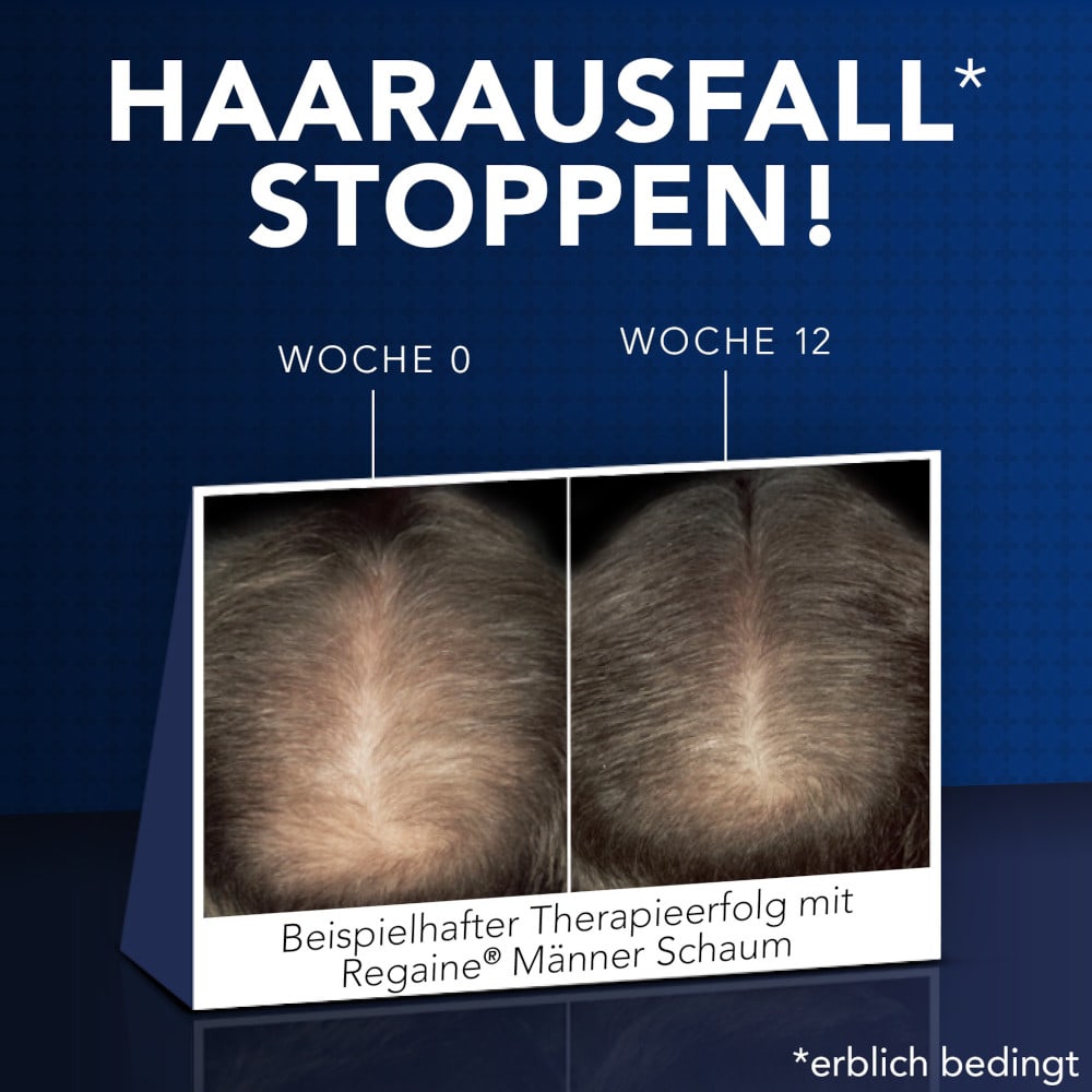 Regaine MÄNNER SCHAUM Doppelpack 2X3X60 ml Schaum