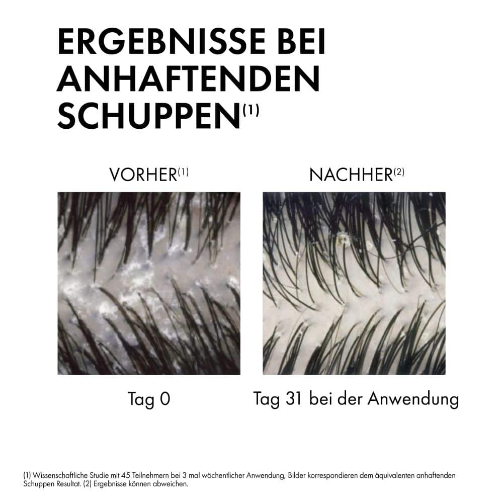VICHY Dercos Anti-Schuppen trockene Kopfhaut Nachfüllpack  500 ml Shampoo