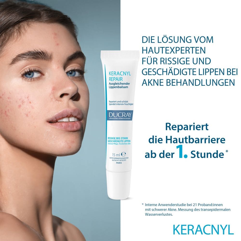 DUCRAY keracnyl Repair Lippenbalsam 15 ml Balsam