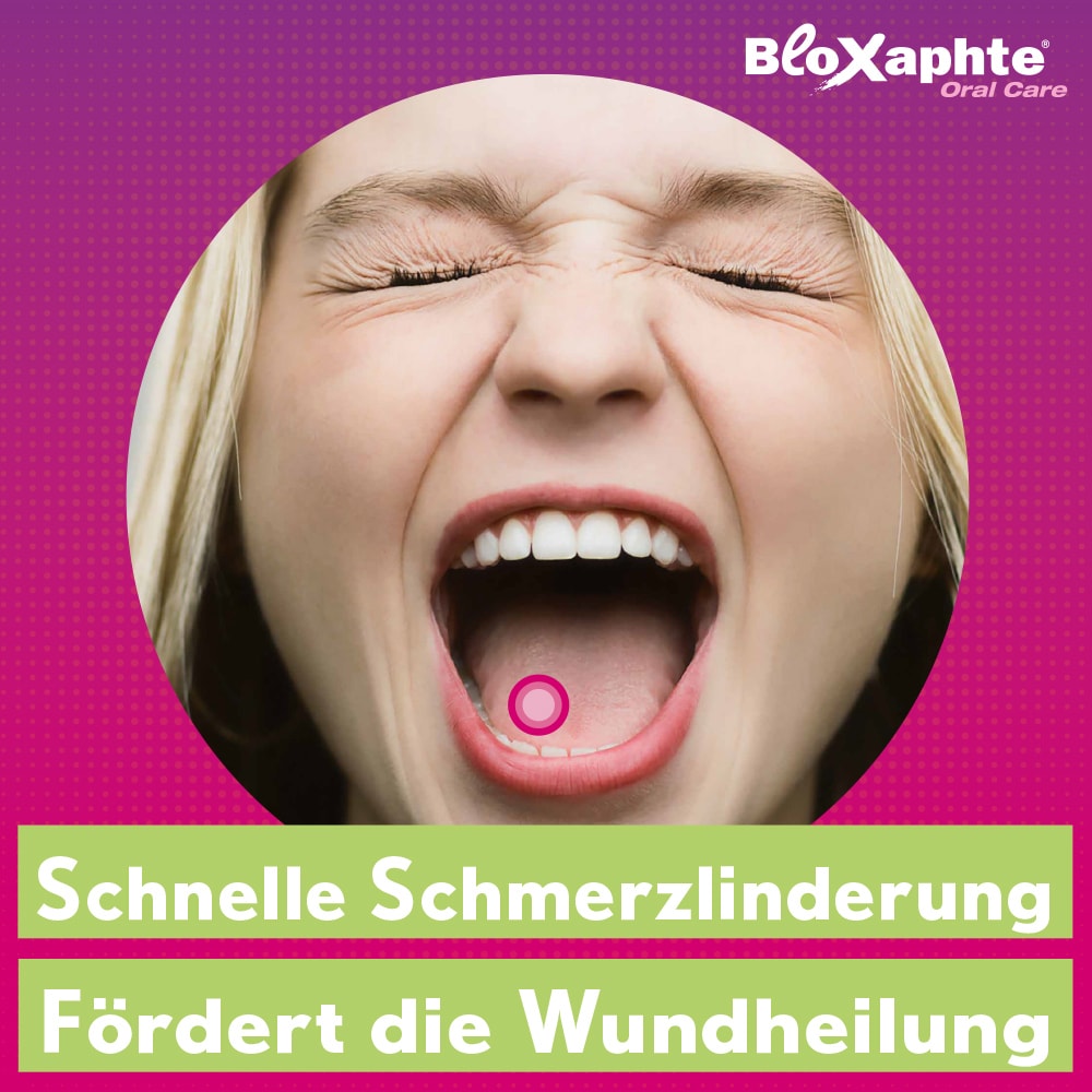 Bloxaphte Oral Care Mundgel bei Aphthen und Verletzungen im Mund 15 ml Gel