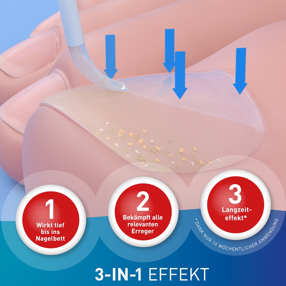 Loceryl Nagellack & Creme Set 1 Sparset