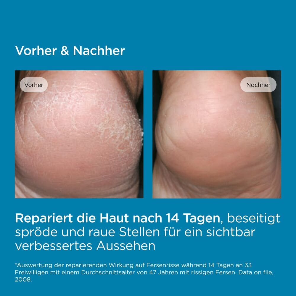 ISDIN Ureadin Podos Hornhaut Fusscreme 75 ml Gel