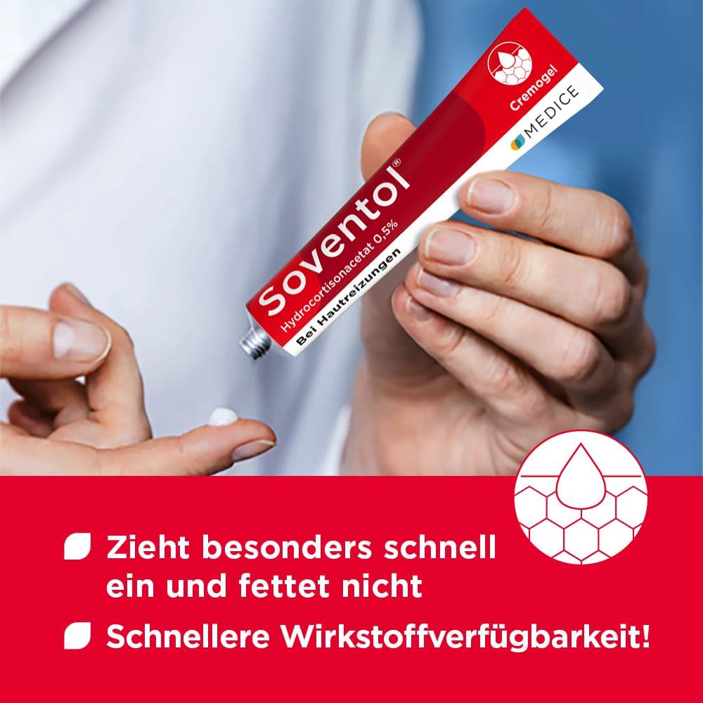 Soventol HydroCortisonACETAT 0,5% bei Hautentzündungen 30 g Creme
