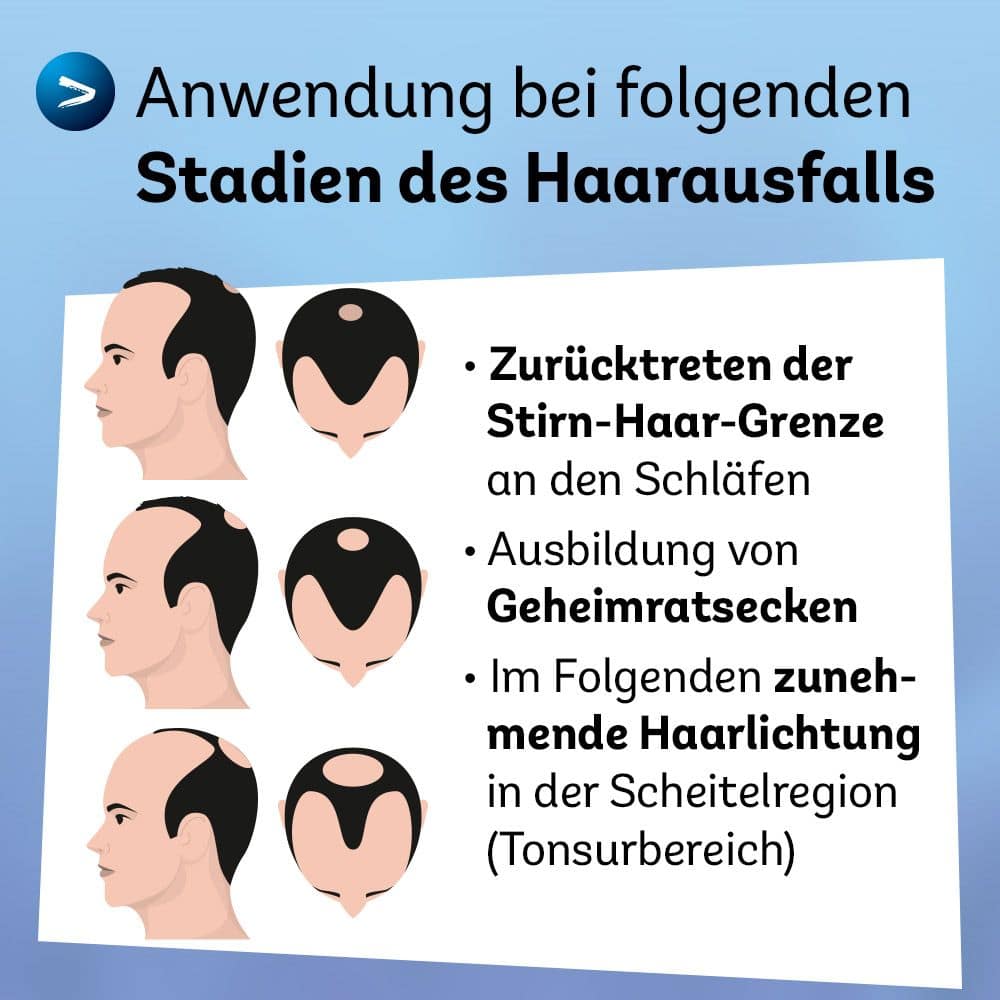 Minoxidil Dexcel 50 mg/ml 3X60 ml Lösung