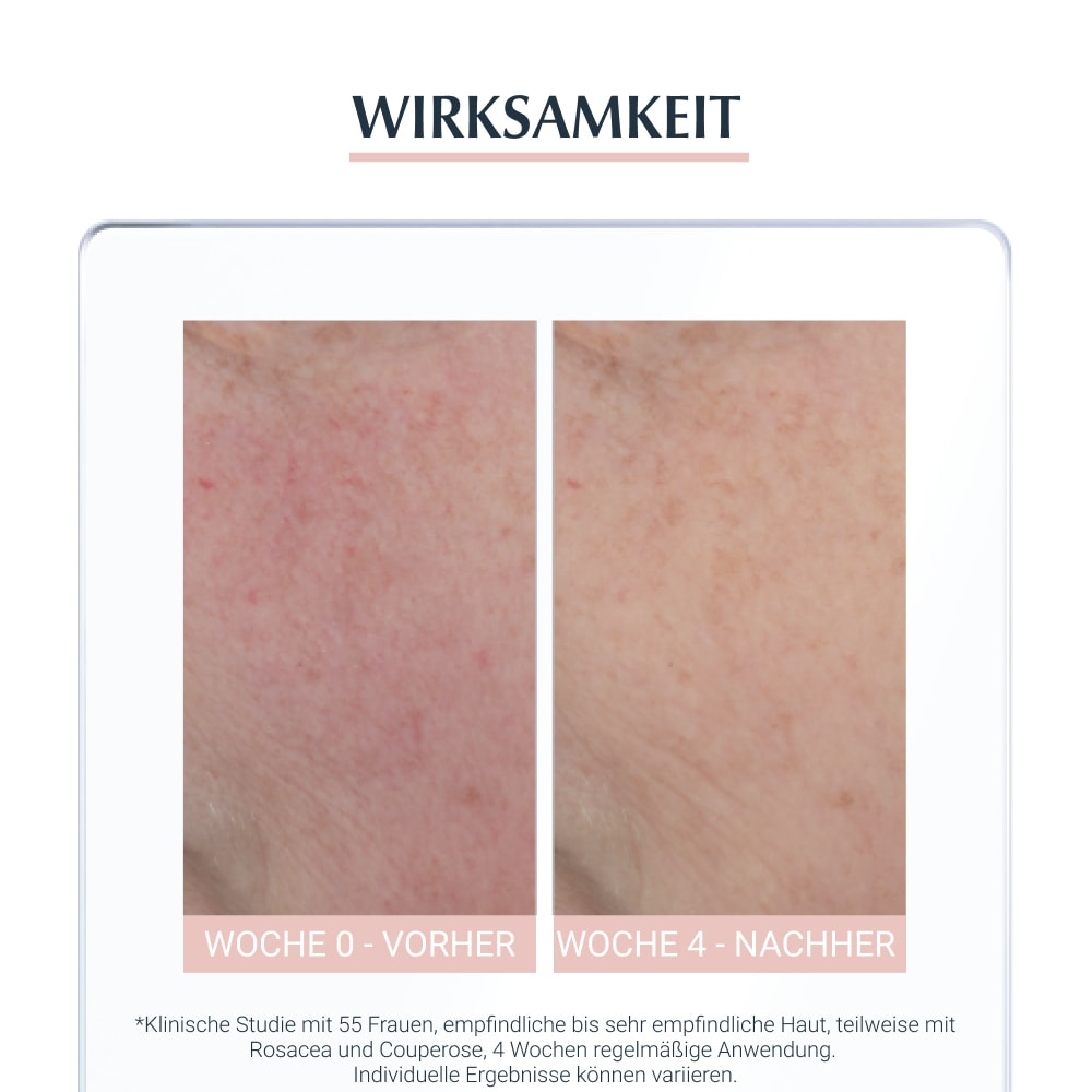 Eucerin AntiRÖTUNGEN  50 ml Creme