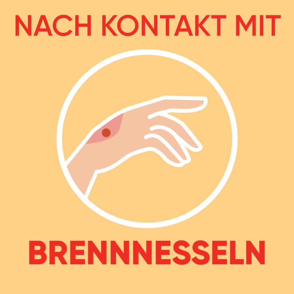 Autan Akut Gel Nach Insektenstichen 25 ml Gel
