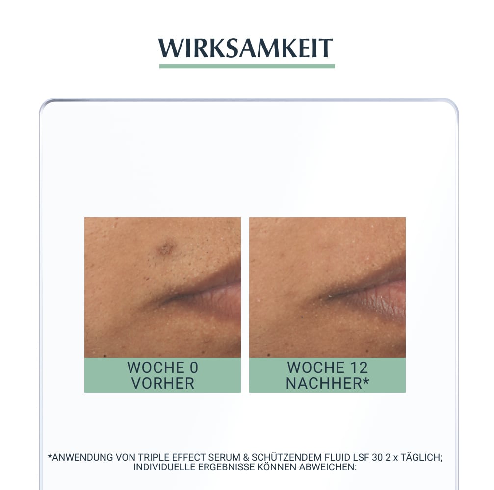 Eucerin DERMOPURE TRIPLE EFFECT SERUM + 3 € sparen* 40 ml Konzentrat