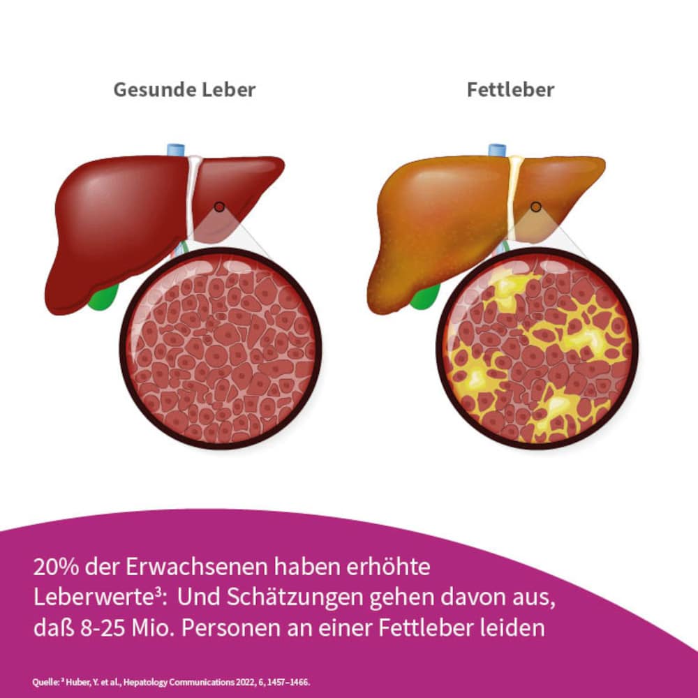 beh Leber  30 St Kapseln