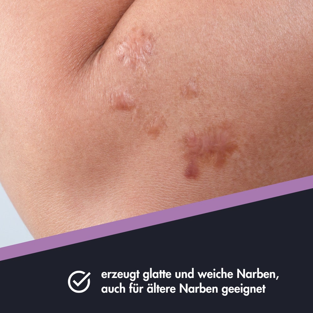 ENSBONA Narbenpflege 20 ml Salbe