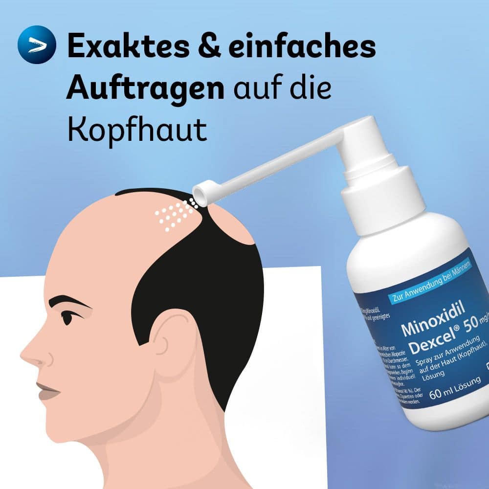 Minoxidil Dexcel 50 mg/ml 3X60 ml Lösung